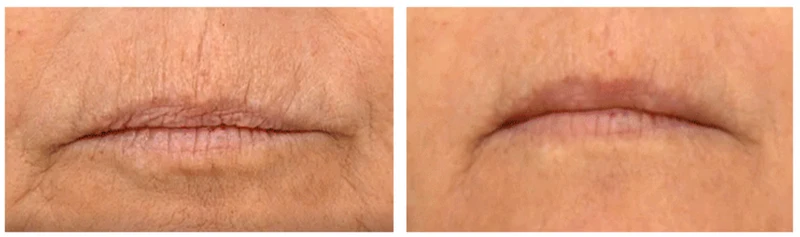 Advanced Line Lift Serum | 45 Anwendungen