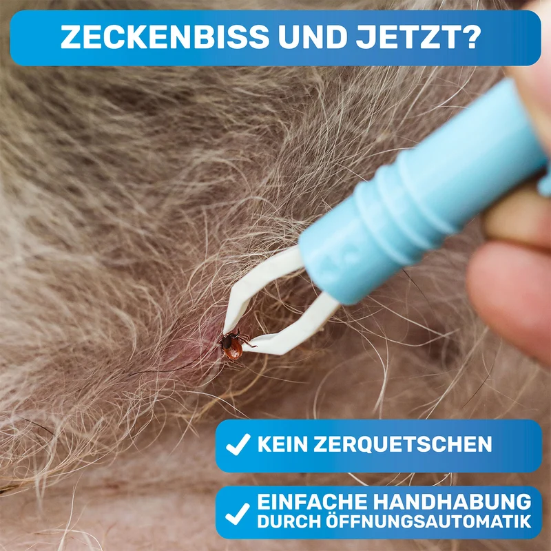 Automatische Zeckenzange, Zeckenentferner
