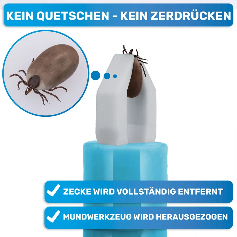 Automatische Zeckenzange, Zeckenentferner